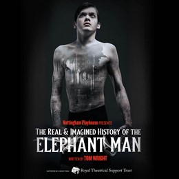 The Real and Imagined History of The Elephant Man 